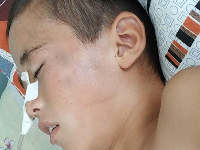 Появились новые подробности инцидента с избиением 11-летнего мальчика из Хорезма
