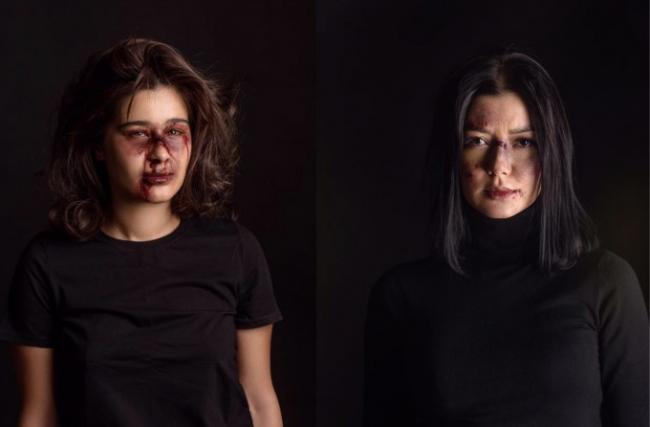 Племянница Алишера Усманова показала себя побитой ради фотовыставки в поддержку прав женщин