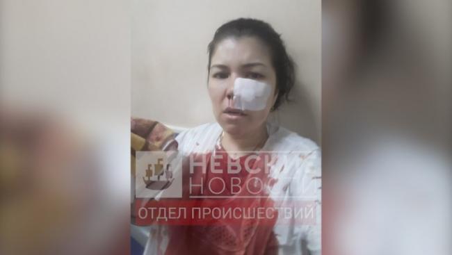 Видео: В Петербурге пьяный мужчина выстрелил в лицо гражданки Узбекистана