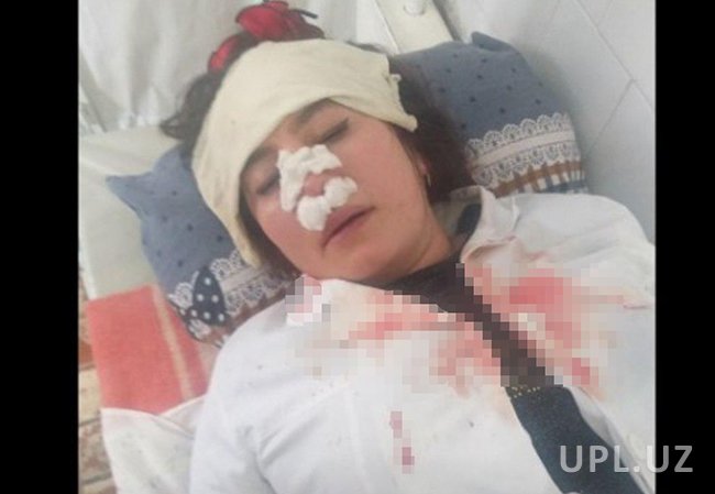 В Фергане медсестра была избита за просьбу пропустить женщину с ребенком без очереди