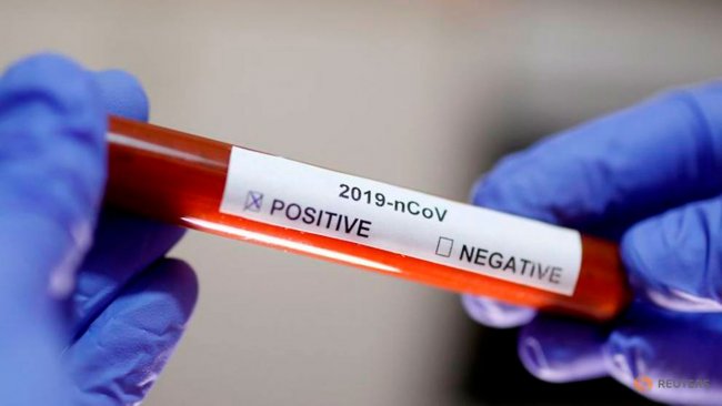 Президент поручил приобрести 300 тысяч тест-систем для диагностики коронавируса