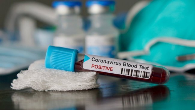 В Узбекистане количество зараженных коронавирусом достигло 88 человек