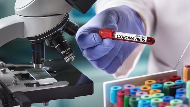 В Узбекистане частные медицинские лаборатории смогут брать тесты на коронавирус