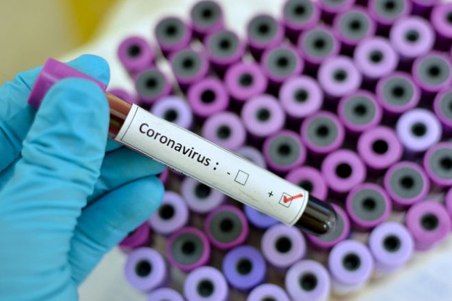 В Узбекистане количество зараженных коронавирусом достигло 167 человек