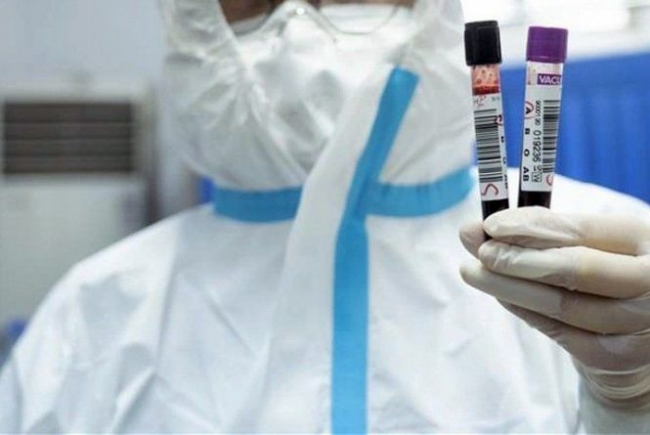 В Узбекистане количество зараженных коронавирусом увеличилось