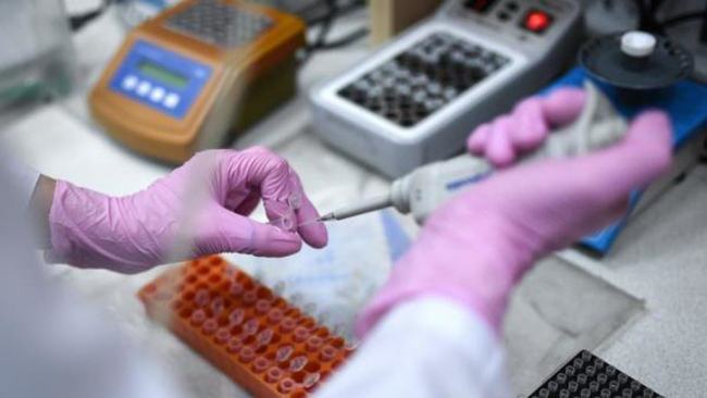 В Узбекистане начнется производство тест-систем для диагностики коронавируса