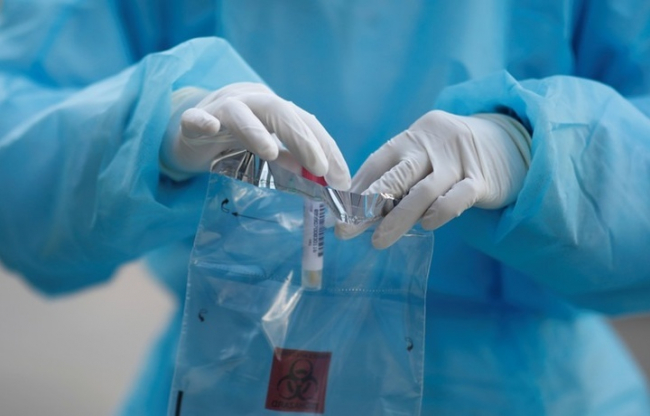 Количество зафиксированных случаев заражения COVID-19 в Узбекистане приблизилось к 2600