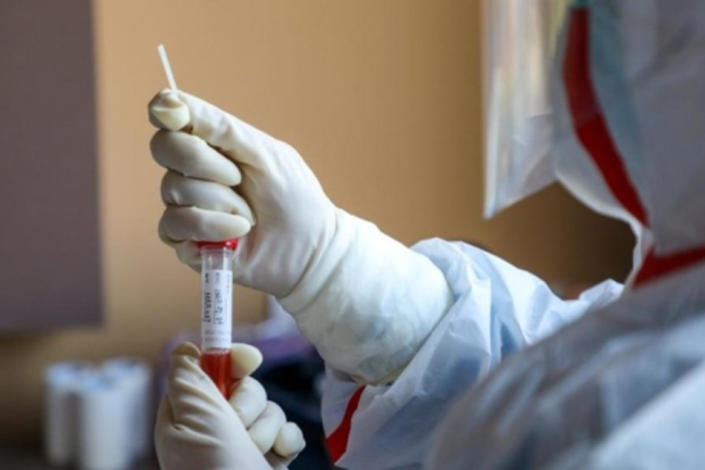 В Узбекистане резко увеличилось количество зараженных коронавирусом