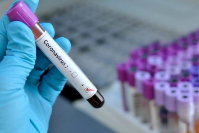 В Узбекистане коронавирус выявлен еще у 25 человек