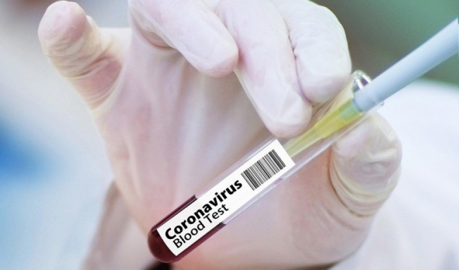 У сына и дочери продавца рынка Урикзар обнаружен коронавирус