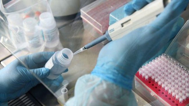 За прошедшие сутки в Узбекистане коронавирус выявлен у 118 граждан
