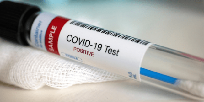 За время пандемии в Узбекистане было проведено более 865 тысяч тестов на коронавирус