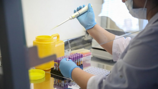 В Ташкенте коронавирус выявлен среди населения у 14 граждан