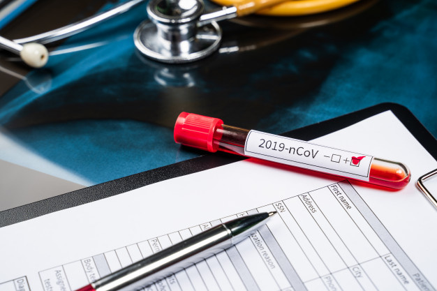 В Узбекистане коронавирус обнаружен еще у 28 граждан