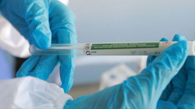 В Ташкенте коронавирус выявлен у 9 граждан среди населения