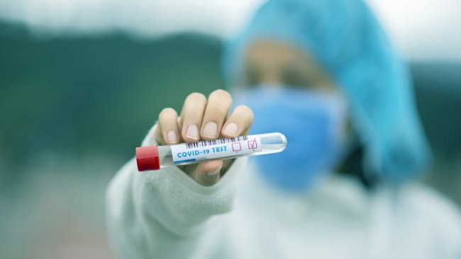 В Узбекистане коронавирус выявлен еще у 63 человек