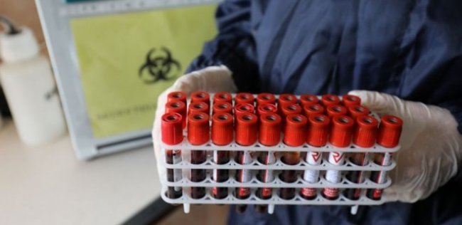 В Узбекистане коронавирус выявлен еще у 123 человек