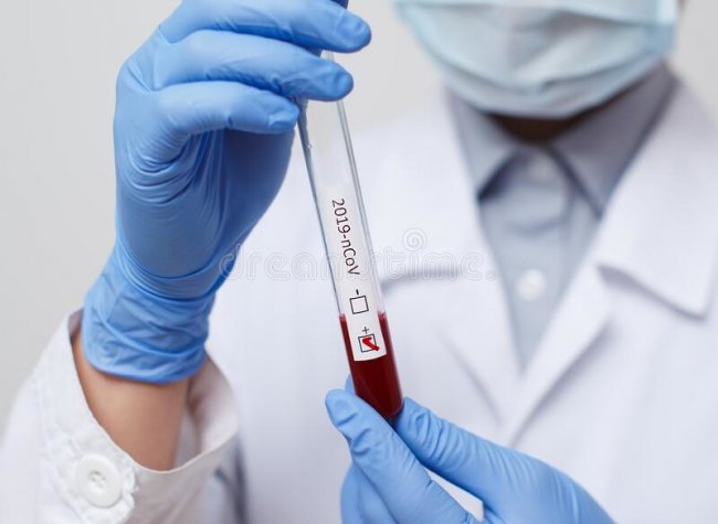 В Узбекистане количество скончавшихся пациентов с коронавирусом продолжает увеличиваться