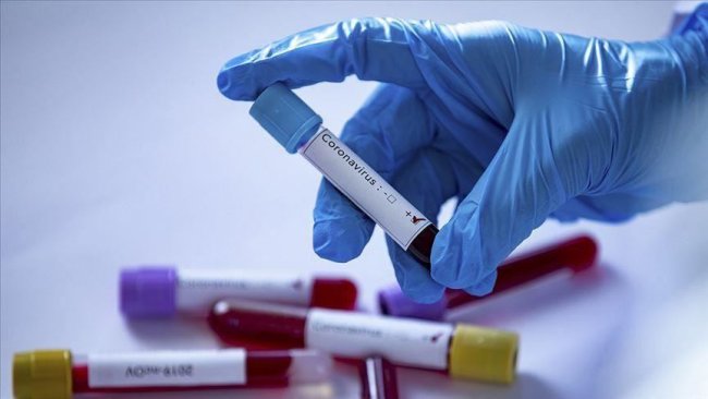 В Ташкенте среди населения выявили 66 зараженных коронавирусом