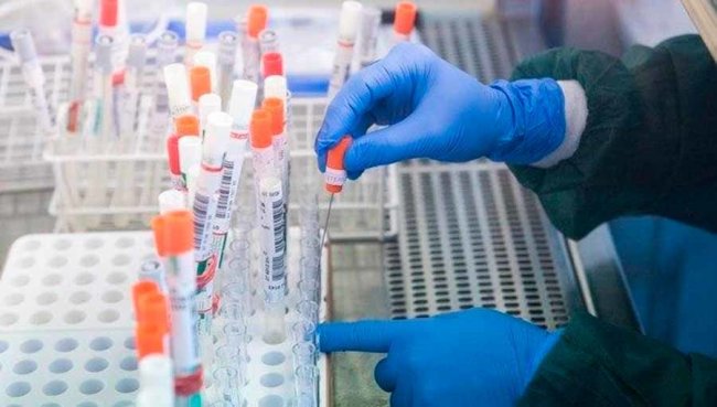 Минздрав Узбекистана отчитался о новых случаях заражения коронавирусной инфекцией