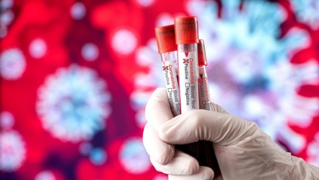 В Узбекистане коронавирус выявлен еще у 102 человек