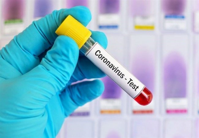 В трех регионах Узбекистана выявлены новые зараженные коронавирусом