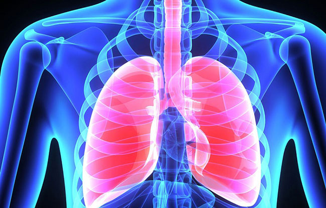 Пневмония. Что нужно знать о воспалении легких?
