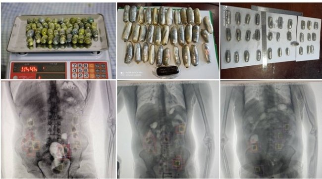 В Сурхандарье задержаны три человека, пытавшихся провезти наркотики во внутренних органах