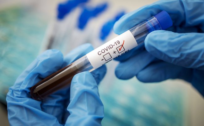 В Узбекистане коронавирус выявили еще у 144 человек
