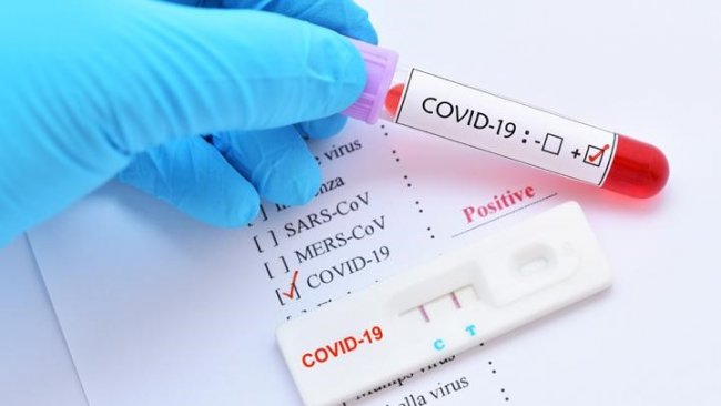 В Узбекистане коронавирус выявили еще у 212 человек
