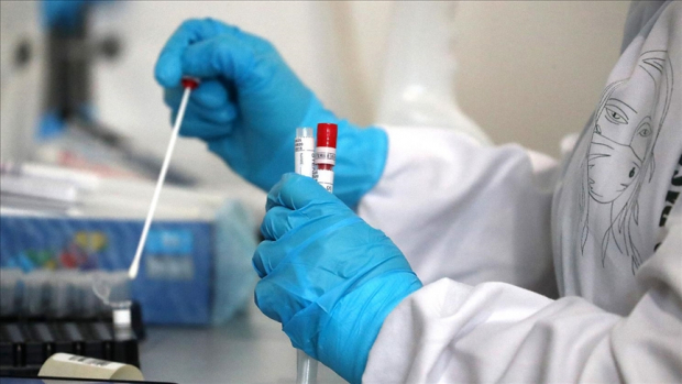 В Узбекистане коронавирус выявили еще у 419 человек