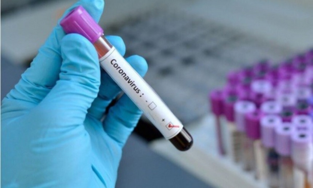 В Узбекистане коронавирус выявили еще у 292 человек