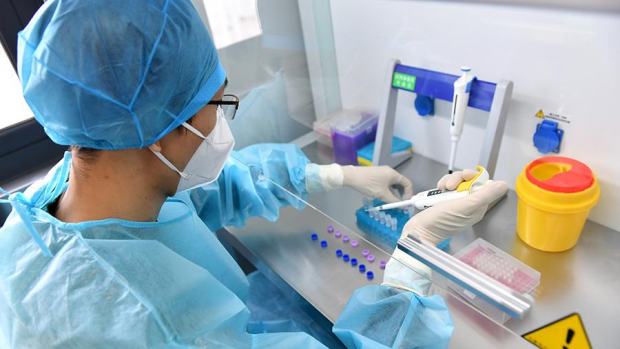 Минздрав Узбекистана выразил обеспокоенность увеличением количества зараженных коронавирусом