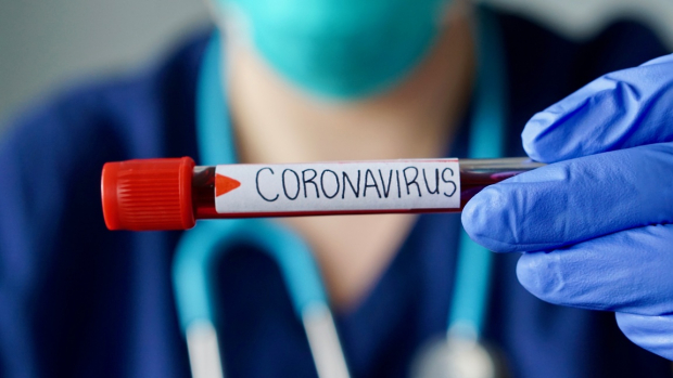 В Узбекистане коронавирус выявили у 876 человек