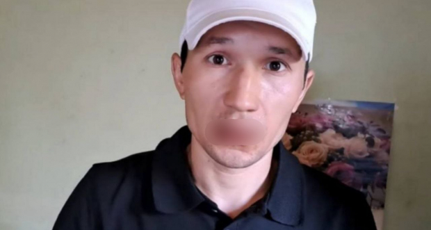 В Ташкентской области мужчина зашил себе рот и объявил голодовку