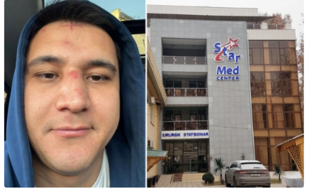 СМИ: Медики, оперировавшие узбекского блогера Mittivine, не имели квалификационной категории