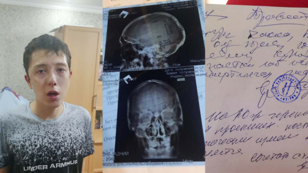В Алмалыке дважды избили 16-летнего парня, страдающего эпилепсией