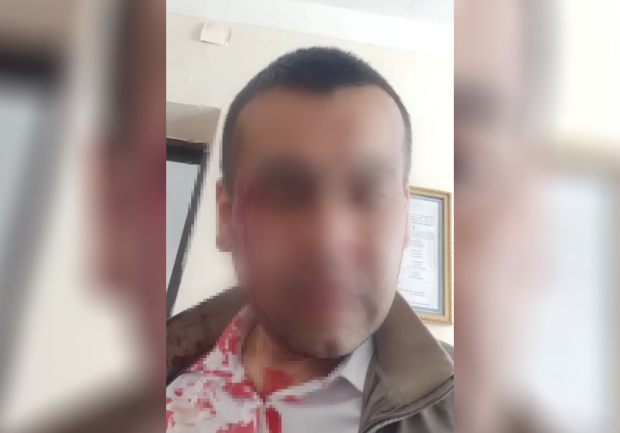 В Фергане жестоко избили учителя физкультуры — видео