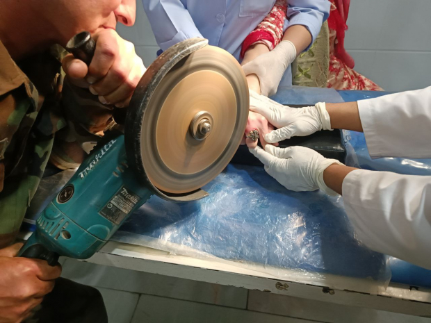 В Андижане женщине пришлось обращаться за помощью к сотрудникам МЧС, чтобы снять с пальца серебряные кольца
